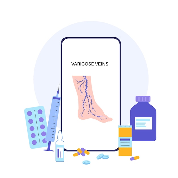 Vector tratamiento de venas varicosas