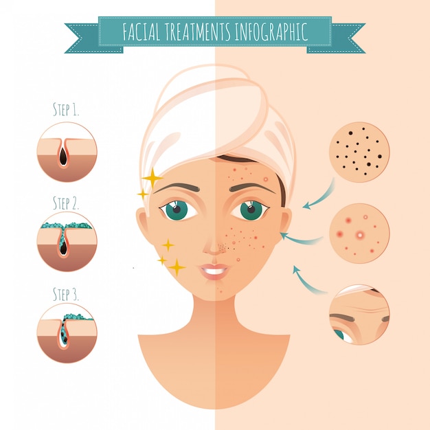 Vector tratamientos faciales infográficos. iconos faciales de acné, granos, arrugas, mascarilla facial