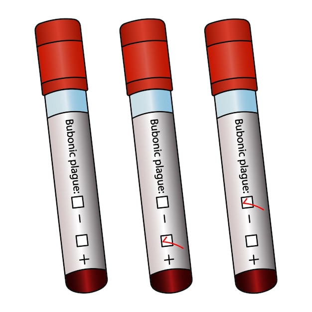 Tubos de ensayo con análisis de sangre de pacientes con peste bubónica, un conjunto de muestras clínicas