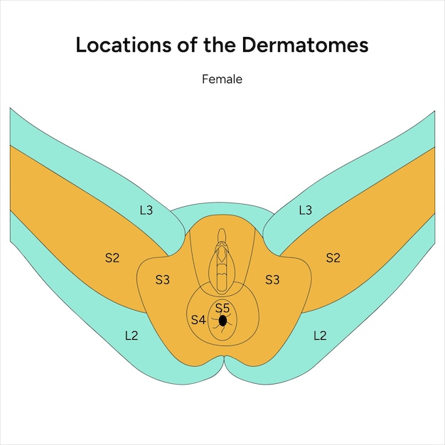 Vector ubicación de los dermatomas hembra