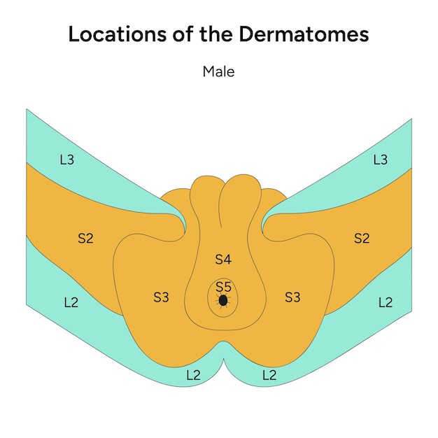 Ubicaciones de los dermatomas masculinos