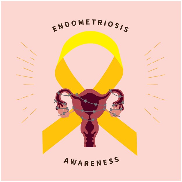 Vector el útero sobre una cinta amarilla de endometriosis