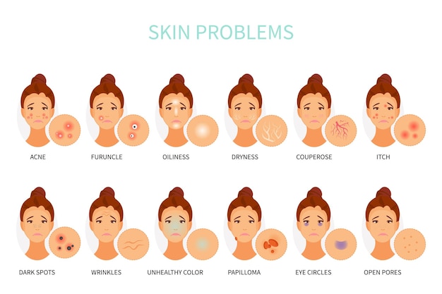 Varios problemas de la piel dermatología y cosmetología.