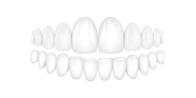 Vector 3d Render realista de prótesis dentales blancas en primer plano Odontología aislada