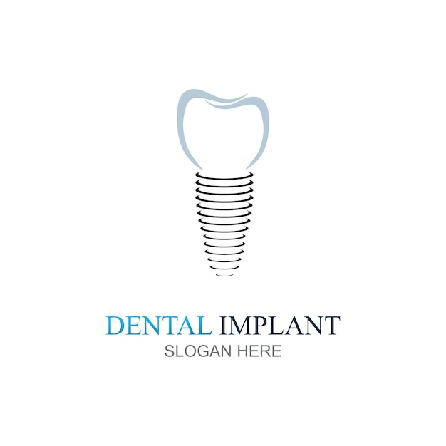 Vector de concepto de diseño del logotipo del implante dental plantilla del logotipo de Dental Care