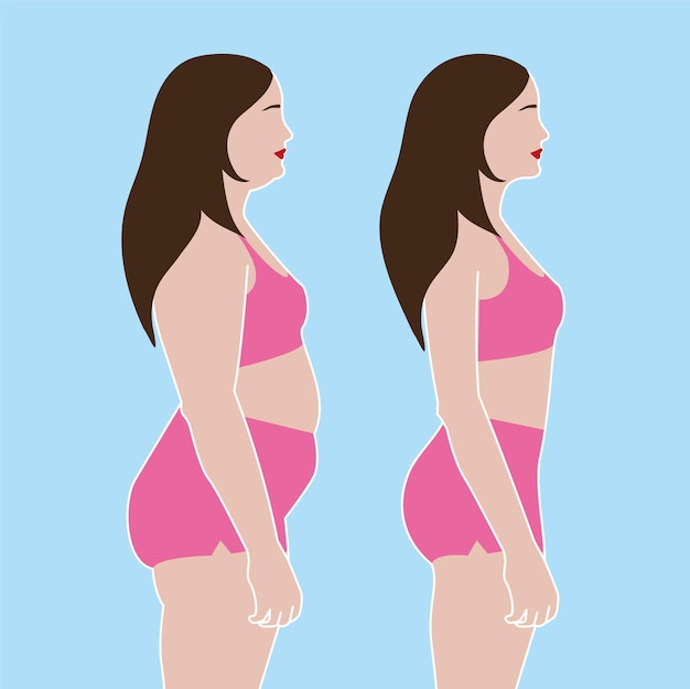 Vector vista antes y después de una escultura de cuerpo femenino de liposucción