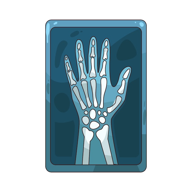 x ray