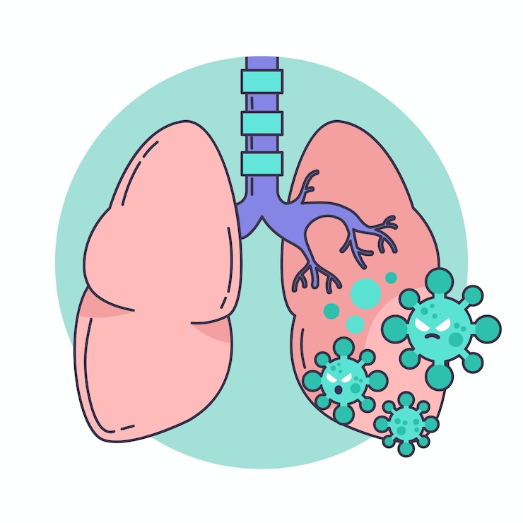 Vector Gratis coronavirus penumonia illustration