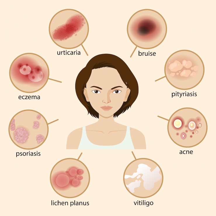 Vector Gratis diagram showing different sickness