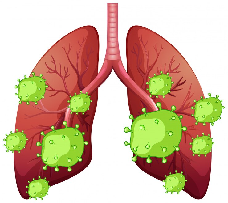 Vector Gratis human lungs and coronavirus cells on white background