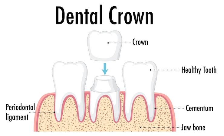 Vector Gratis infographic of human in dental crown