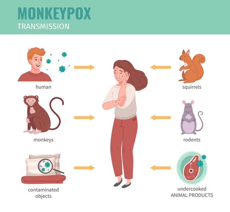 Vector Gratis monkey pox virus infographics with transmission ways from human and animals vector illustration