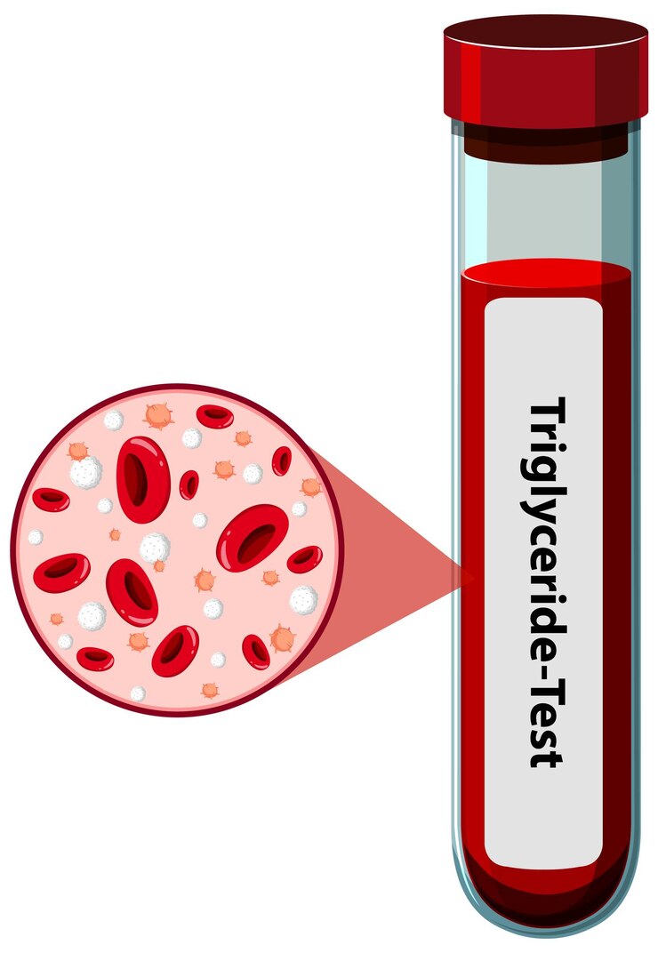 Vector Gratis triglyceride blood test illustration