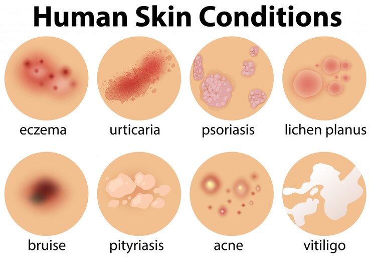Vector a set of human skin conditions