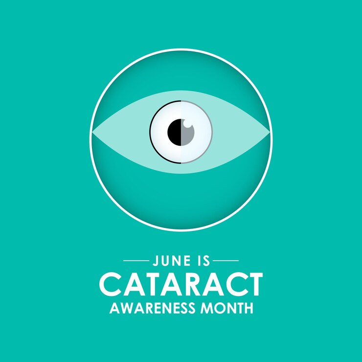 Cataract Awareness Month is observed annually in June A progressive clouding of the eyes lens