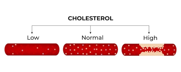Cholesterol Low Normal and High Blood sugar