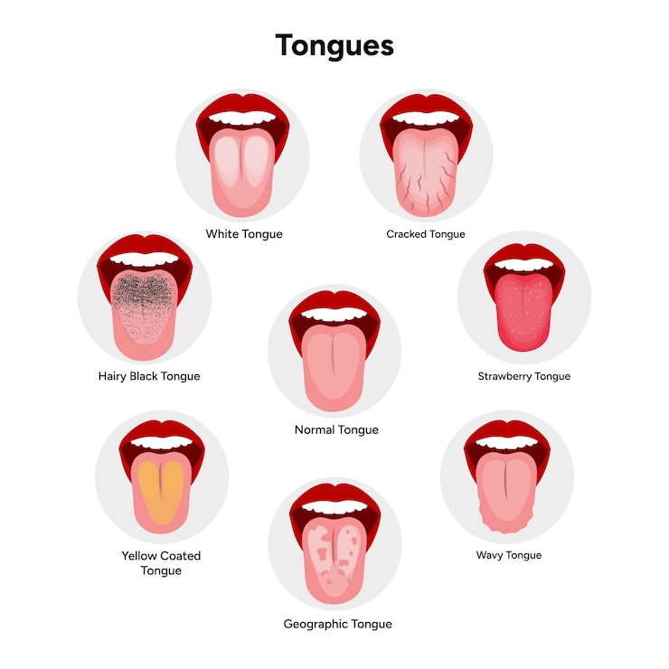 Vector cracked strawberry normal geographic yellow coated black hairy and white tongues