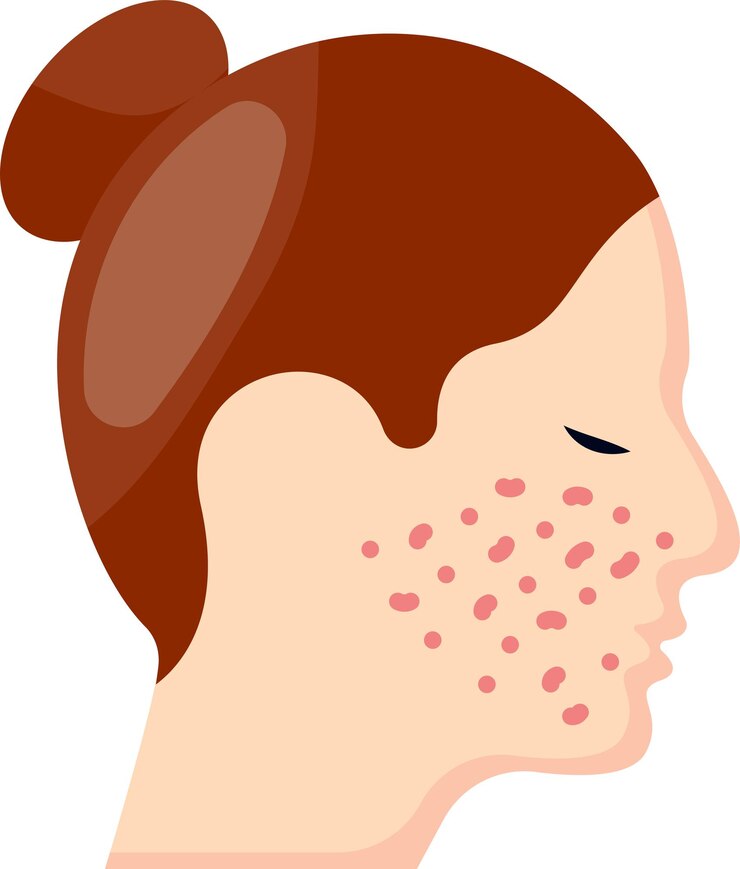 Vector desain vektor perawatan jerawat, peremajaan kulit, atau mikrodermabrasi, kecantikan dan perawatan pribadi kosmetik