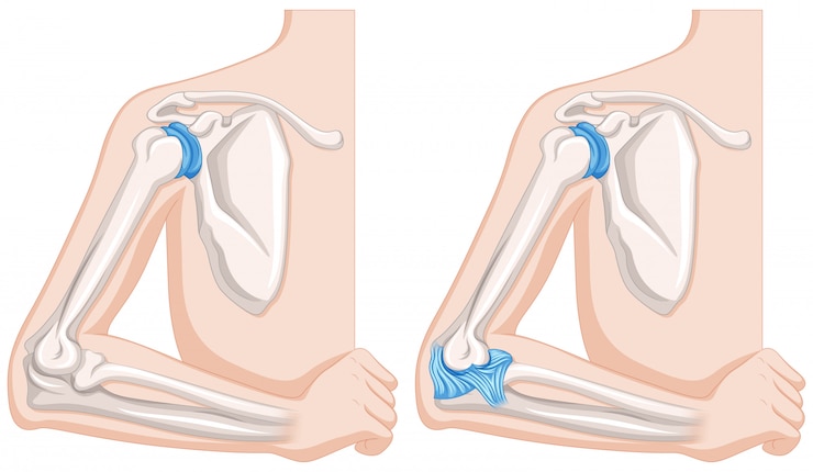 Vector diagram close up sendi siku manusia