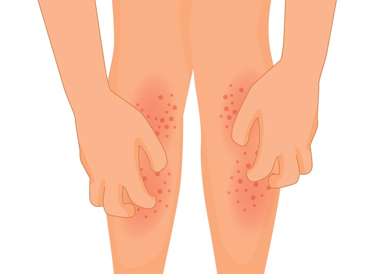 Vector hands scratching itchy leg with rash dry skin because of allergic reaction
