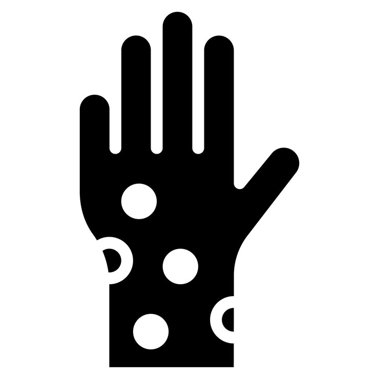 Vector hives icon vector image can be used for allergy symptoms