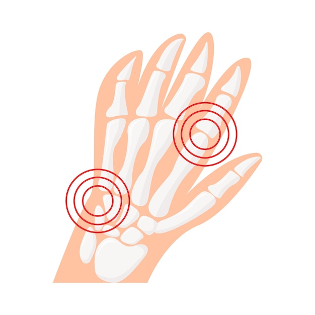 Illustration of bone