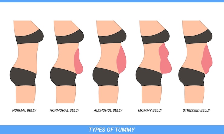 Illustration of Types Of Tummies for woman