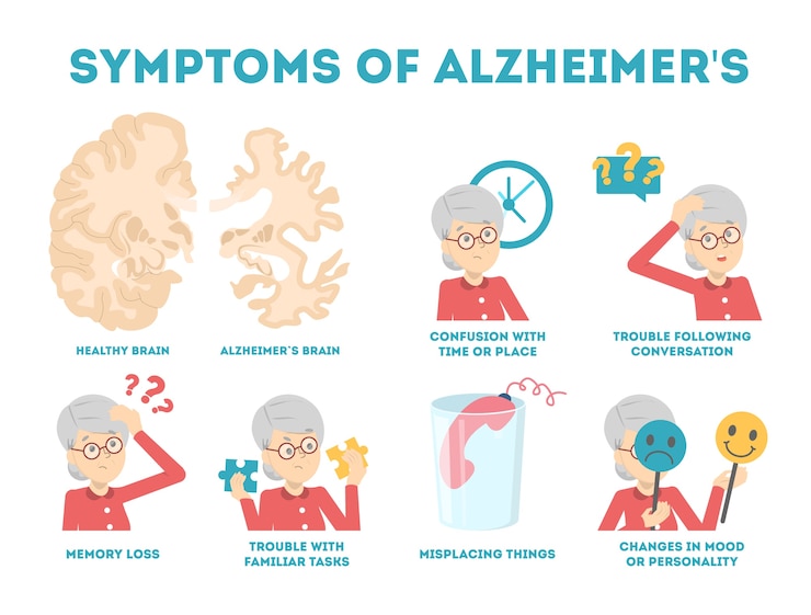 Vector infografis gejala penyakit alzheimer. kehilangan memori dan masalah