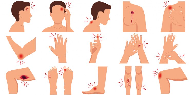 Vector pain in the human body parts physical injury flat set.
