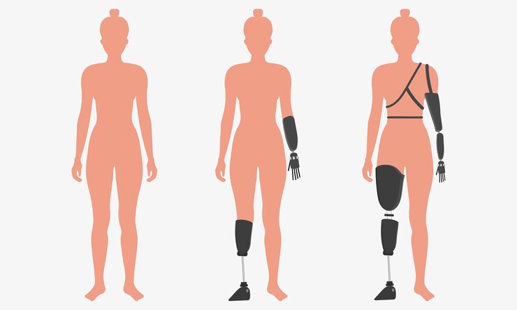 Vector people prosthesis amputation inclusion