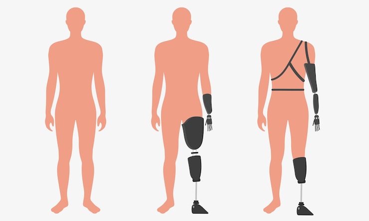 Vector people prosthesis amputation inclusion