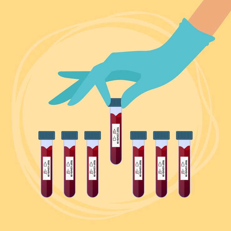 Vector scientist holding coronavirus positive blood test tubes