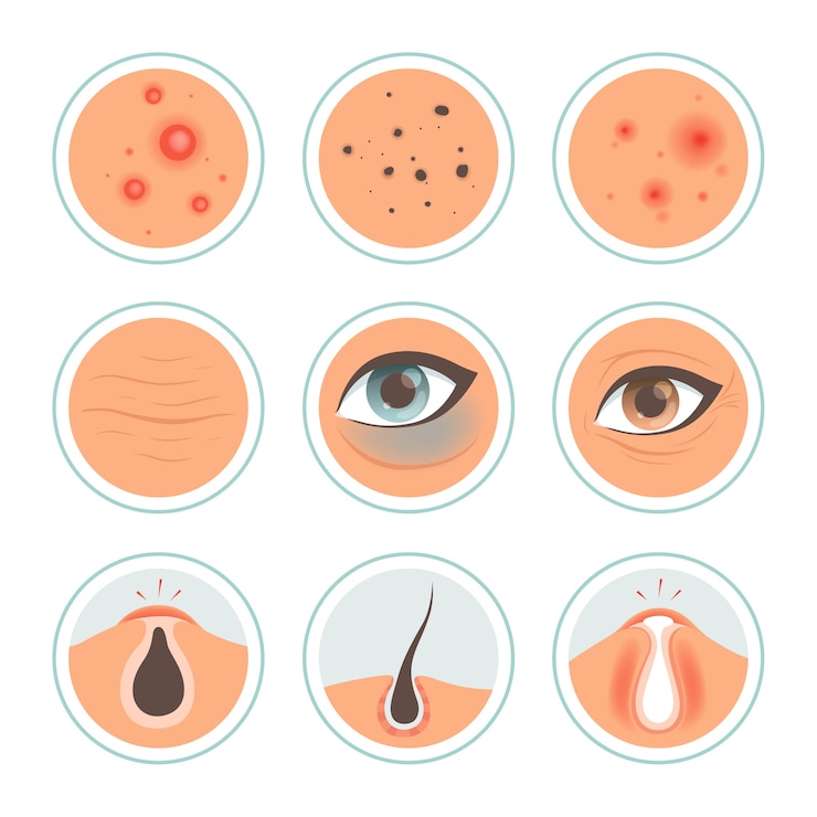 Vector skin problems. dark circles woman infection spot washing skin oily face ages pore cleanse medical icon. problem skin dermatology, treatment and care wrinkle illustration