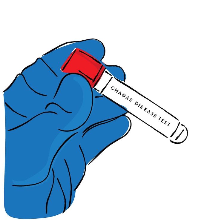 Vector test of chagas disease