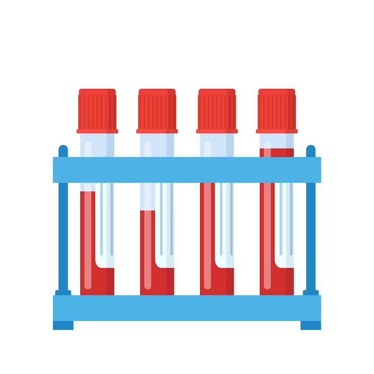 Vector test tube with blood on rack.
