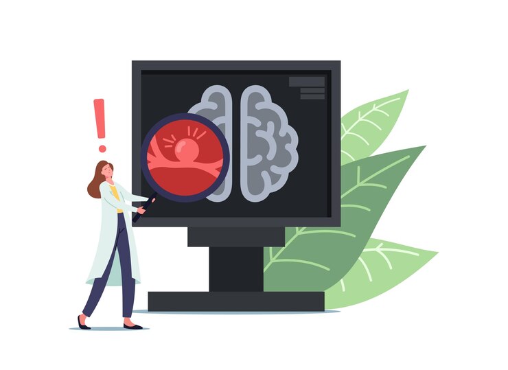 Vector tiny doctor female character in white medical robe holding huge magnifier at pc screen with tomography of human brain with aneurysm bulg on vessel wall, danger sickness. cartoon vector illustration