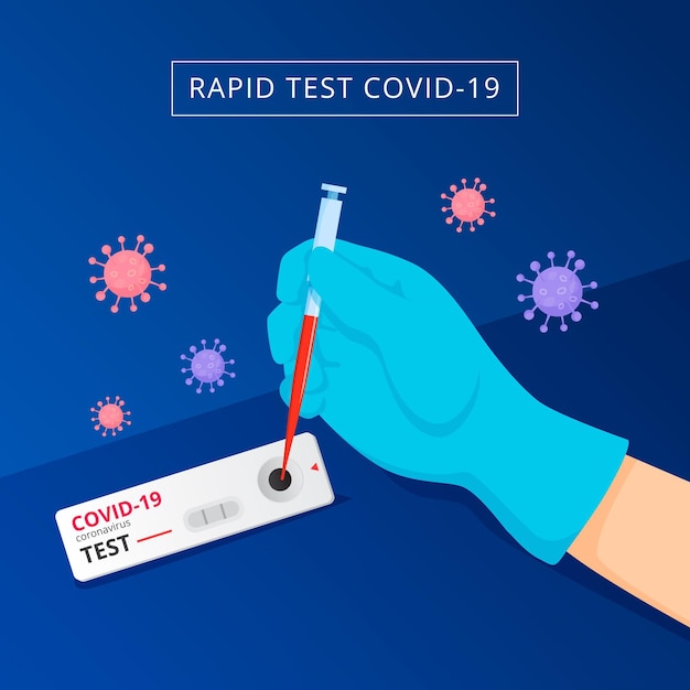 Art des coronavirus-tests