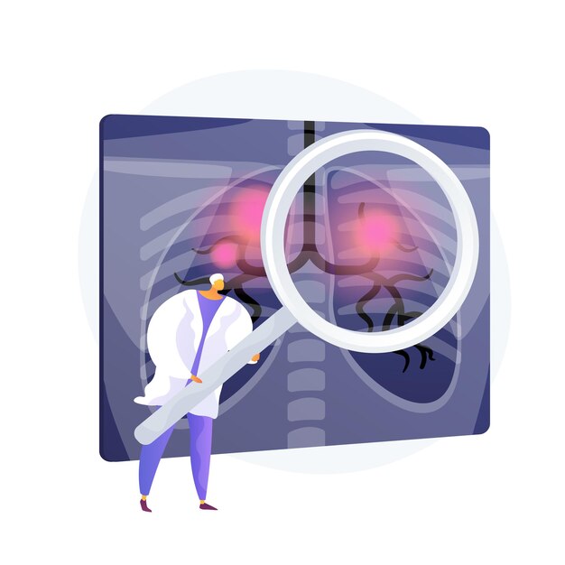 Atemwegserkrankungen, medizinisches Problem. Lungenkrebs, Asthma bronchiale, Diagnose einer Lungenentzündung. Röntgenaufnahme der Brust mit Entzündungen. Designelement Radiologie. Vektor isolierte Konzeptmetapherillustration