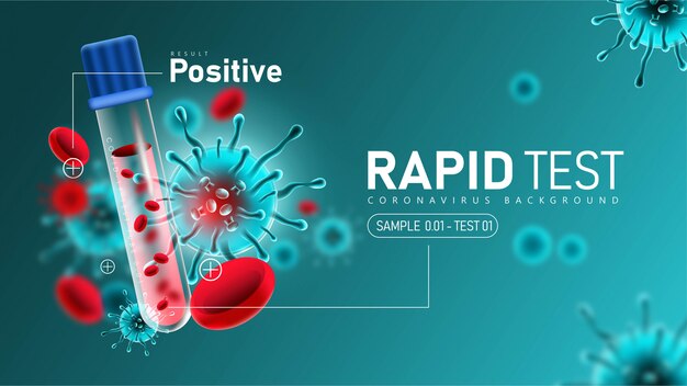 Coronavirus 2019-ncov-Schnelltest mit positivem Ergebnis