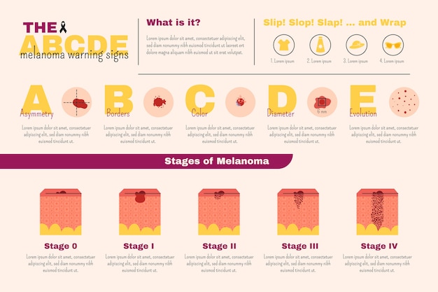 Gesundheit handgezeichnetes flaches melanom infografik