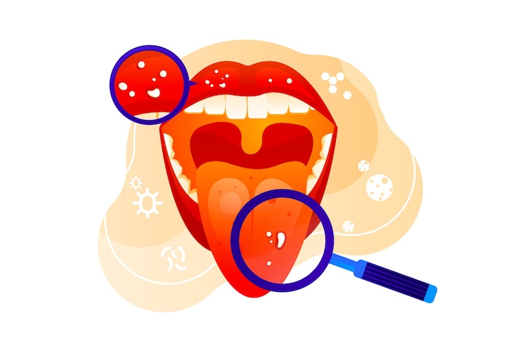 Kostenlose Vektor gradienten-stomatitis-illustration