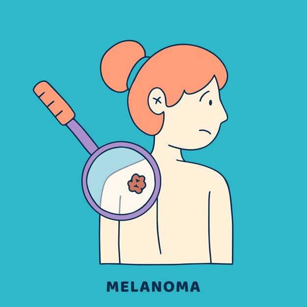 Hand gezeichnete Melanomillustration des flachen Designs