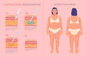 Kostenloser Vektor handgezeichnete fettabsaugung mit flachem design infografik