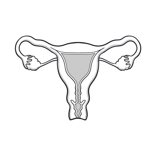 Handgezeichnete Uteruszeichnung