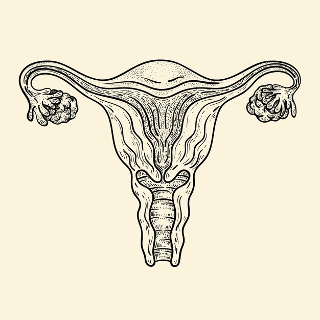 Handgezeichnete Uteruszeichnung