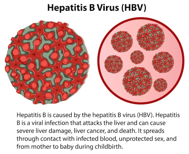 Kostenloser Vektor hepatitis b virus hbv mit erklärung