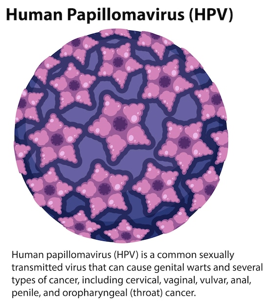 Kostenloser Vektor humanes papillomavirus mit erklärung