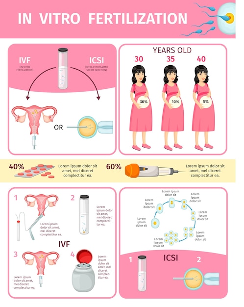 Kostenloser Vektor in-vitro-fertilisation infografik-konzept