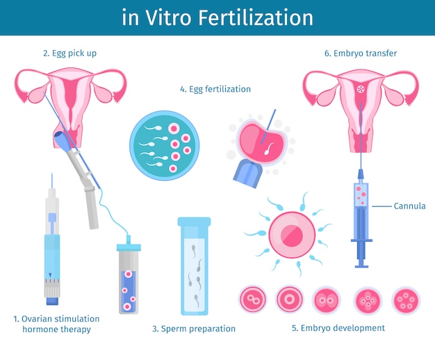 Kostenloser Vektor in-vitro-fertilisationsprozesskonzept