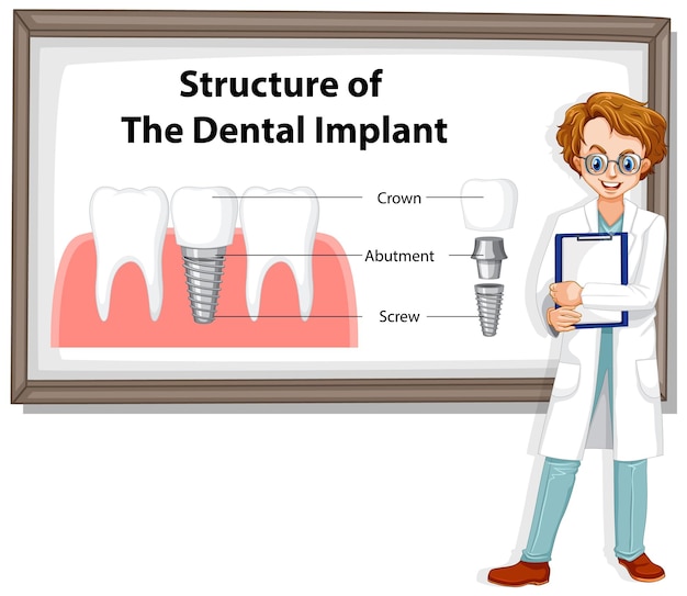 Infografik des Menschen in der Struktur des Zahnimplantats